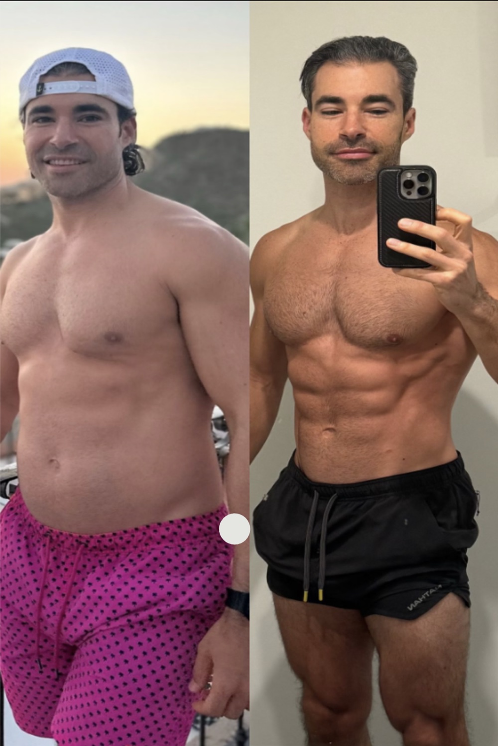 William Bosch before and after